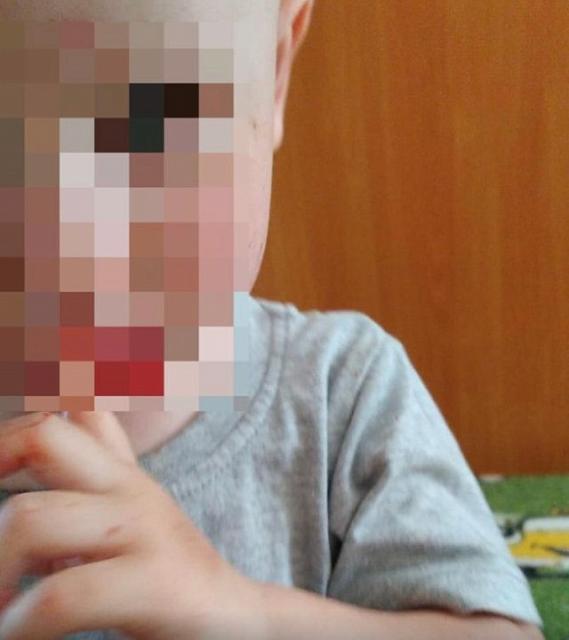 В Ставрополе проверяется сообщение об избиении ребёнка в детском саду