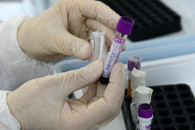 Мишустин продлил положение о распределении тест-систем для диагностики коронавируса 