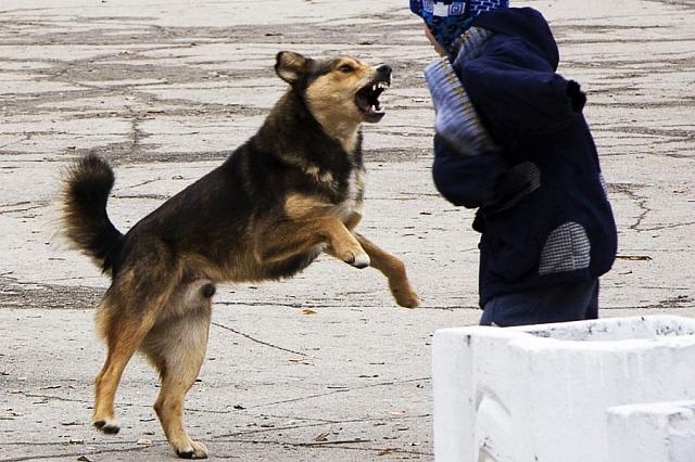На Ставрополье от укусов собаки пострадал ребёнок 